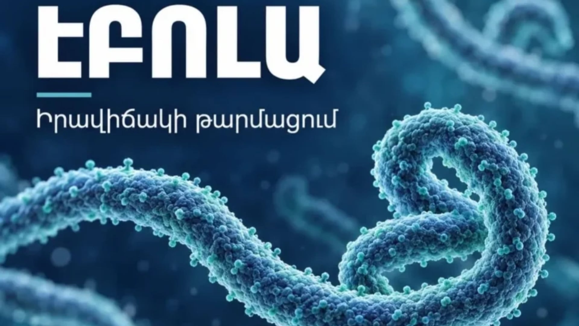 Հայաստանում Էբոլայի տարածման ռիսկը ցածր է