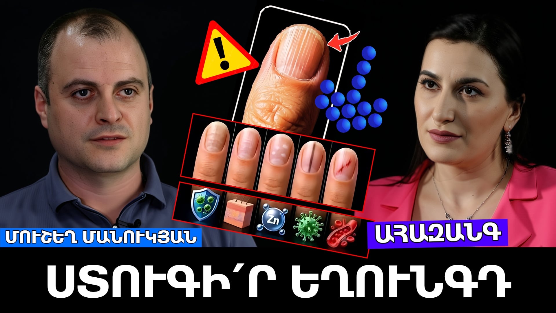 Մի՛ շտապեք խմել հակասնկային դեղեր. Ի՞նչ է թաքնված եղունգների գույնի փոփոխության հետևում. Պարզաբանում է մասնագետը