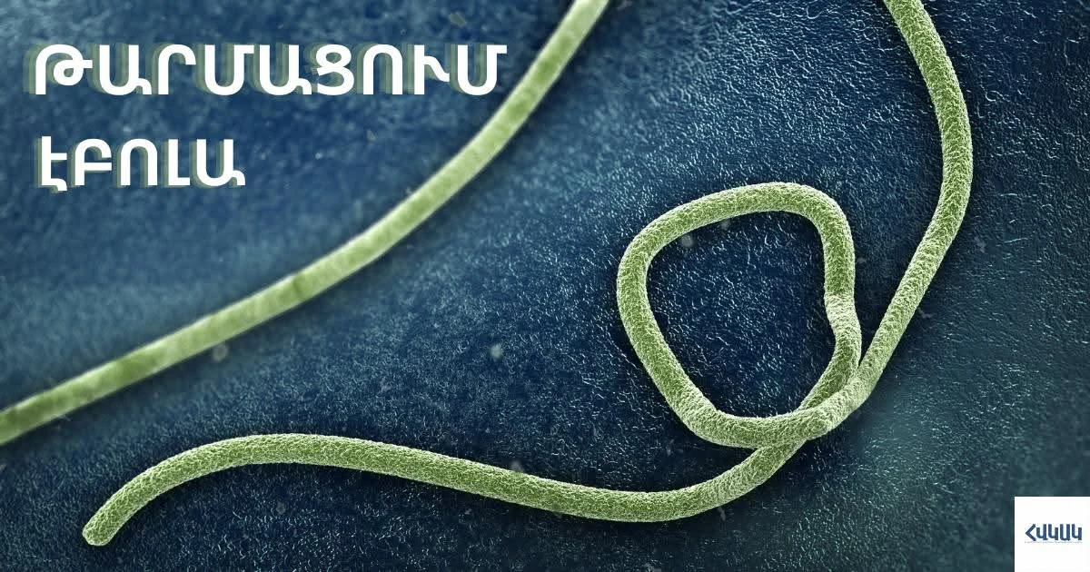Հայաստանի համար Էբոլայի ներմուծման ռիսկը ցածր է գնահատվում
