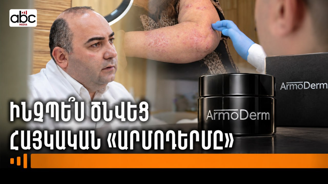Փսորիազը հնարավոր է լուծել. «Արմոդերմի» գաղտնիքը