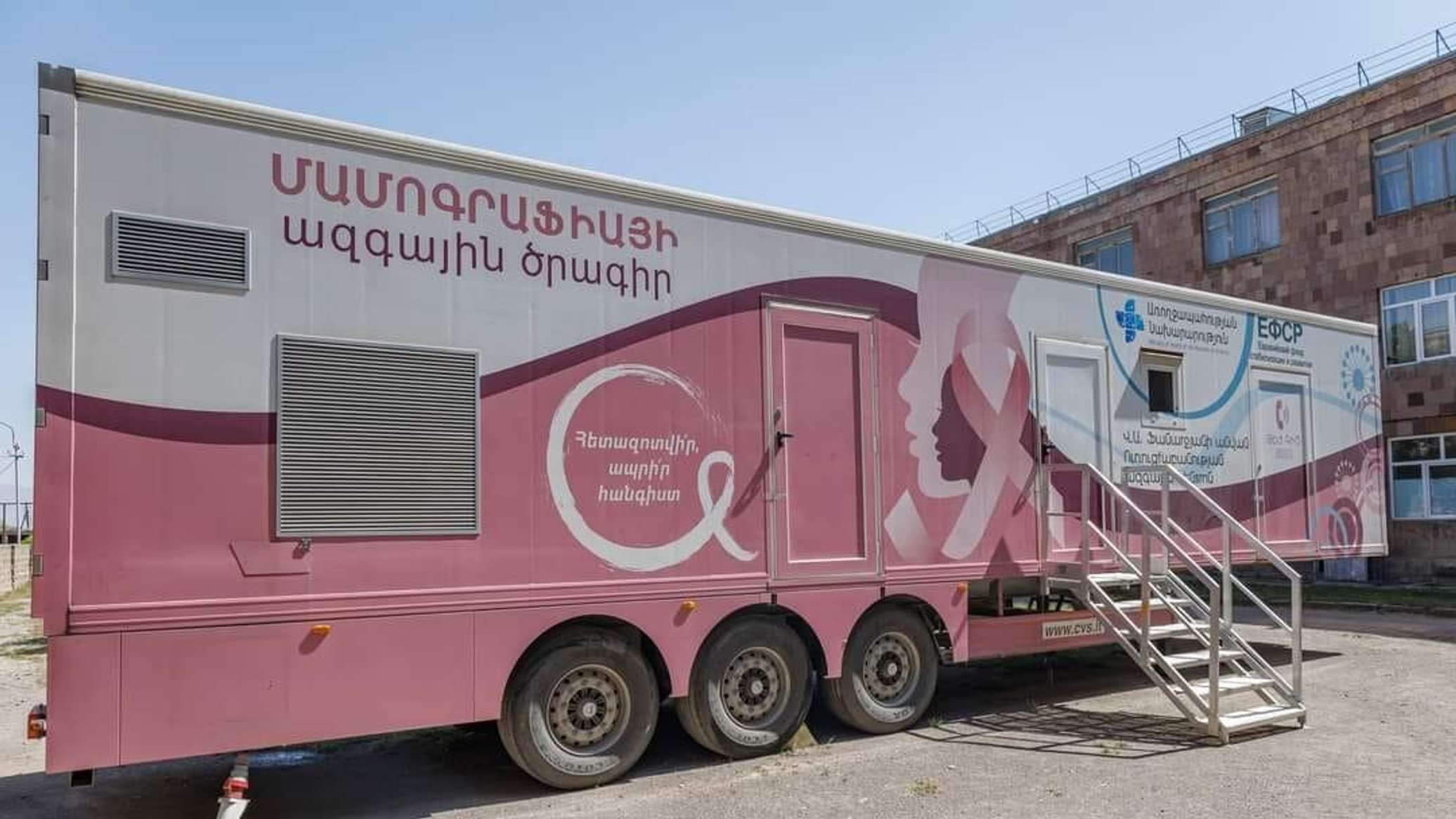 The proportion of breast cancer detection in stage 4 has significantly decreased in Armenia