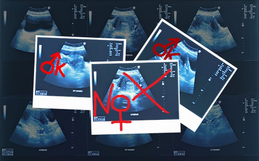 El mercado negro de abortos selectivos en Armenia exige nuevos controles sanitarios